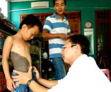 Tìm ra bệnh bé 'người sói' ở Quảng Nam