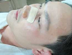 Vụ thanh niên bị đánh gãy mũi: CSGT không sai?