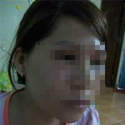 Lời kể đau đớn của nữ tiếp viên bị rạch nát mặt