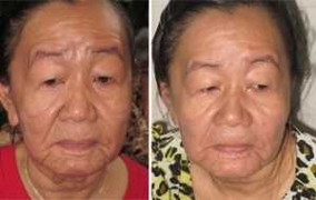 Cô gái Bến Tre hóa bà lão: Thế giới chỉ 2 người mắc