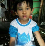 Đình chỉ cô giáo làm bé gái 5 tuổi thâm tím hai tay