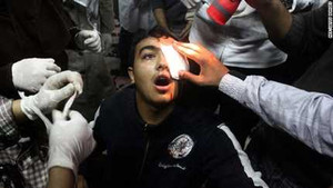 Truy lùng 'kẻ săn mắt' người biểu tình Ai Cập