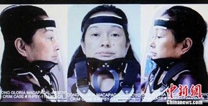 Giám sát cựu Tổng thống Arroyo tại bệnh viện chính phủ