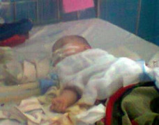 Hai tháng tuổi phải cắt 1m ruột bị hoại