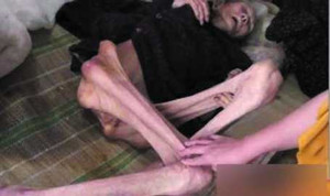 Cụ bà bị con ruột bỏ đói đến chết