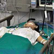 Bỏng quá nặng, cháu bé vụ nổ xe Honda chuyển viện