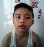 Cô giáo dập đầu học sinh gãy răng, chảy máu