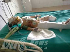 Cháu bé vụ nổ xe Honda kinh hoàng đã tử vong