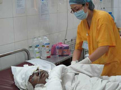 Các nạn nhân vụ cháy gas đang nguy kịch