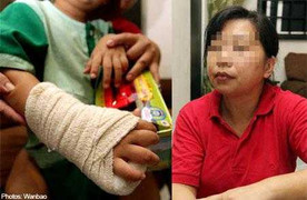 Cậu bé 3 tuổi nghi bị bạn đánh gãy tay ở trường