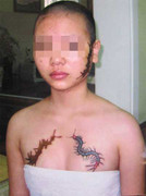 Bắt bà chủ ép thiếu nữ xăm 'quái thú' lên mặt