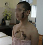 Xăm rết lên mặt thiếu nữ: “Có tiền thì tôi làm