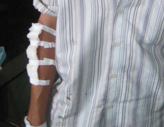 Cà Mau: Người đàn ông dũng cảm bắt cướp