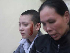 Mẹ khóc ròng vì thiếu nữ bị xăm rết lên ngực, mặt