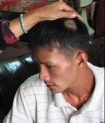 Kỷ luật 6 công an vô cớ bắt người, đánh nhập viện