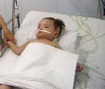 Rơi xuống ao, bé trai 2 tuổi tính mạng nguy kịch