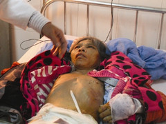 Đổ nước sôi vào chỗ kín, bắt osin dọn bỉm bằng miệng