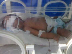 Chủ quan bệnh vàng da, một bệnh nhi 7 ngày tuổi tử vong