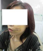 TP.HCM: Thuê giang hồ rạch nát mặt 'tình địch'