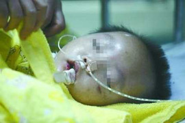 Bé 2 tuổi bị mẹ kế đánh hôn mê, thập tử nhất sinh