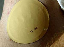 Miếng dán nicotine giúp ngăn bệnh Alzheimer