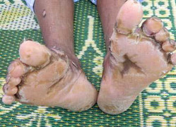 Bệnh lạ khiến 12 trẻ chết: Người dân đóng chặt cửa nhà