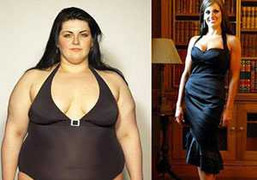 Giảm béo bằng đặt bóng hơi trong… dạ dày