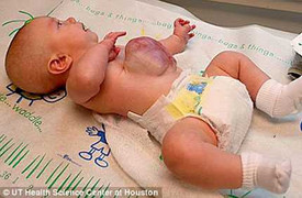 Cậu bé kỳ lạ với nội tạng ngoài bụng