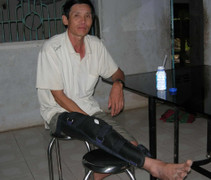 CA xã nổ súng, đánh dân đứt dây chằng vì tội 