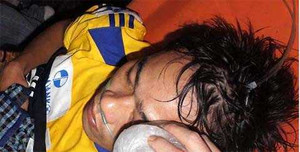 Dính đòn thù, Huy Hoàng ra Hà Nội mổ mắt