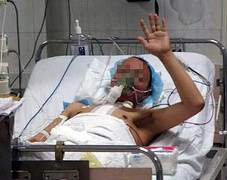 Thêm 1 người chết não hiến tạng, 4 người sống sót