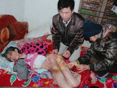 Osin bị xối nước sôi, dọn bỉm bằng miệng được về nhà