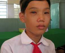 Ông đánh cháu ngoại gây thương tích nhận kiểm điểm