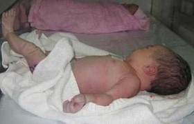 Tiểu đường khi mang thai, con chào đời nặng 6kg