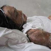 Đánh ghen cô gái xinh đẹp bằng axit gây chấn động