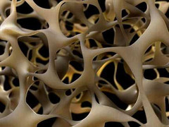 Thuốc tiêu hóa làm tăng nguy cơ gãy xương hông