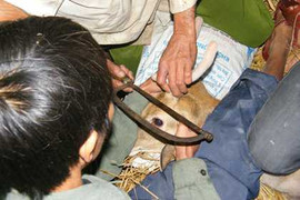 Kỳ thú nghi lễ cắt 