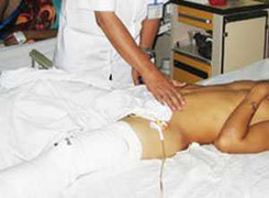 Uống rượu đến vỡ bàng quang