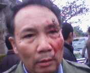 Đi đón dâu, 2 cha con hú vía vì bị nhà gái đuổi đánh