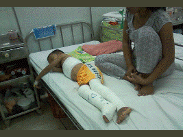 Ghẹo gái, ném bom xăng, một cháu bé bỏng nặng