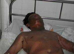 Cà Mau: Nổ bình gas, 3 người thiệt mạng