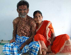 Người đàn ông “mặt quỷ” và tình yêu không ngờ tới