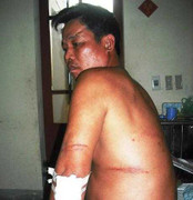 Chém trưởng công an xã vì bị triệu tập