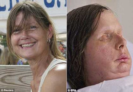 Ngắm khuôn mặt mới của thiếu phụ bị tinh tinh tấn công