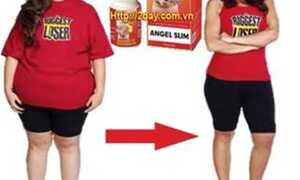 Điều trị thừa cân lâu năm bằng đột phá mới ANGEL SLIM