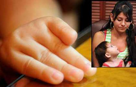 Bất cẩn, y tá cắt đứt nửa ngón tay bé gái 3 tháng tuổi