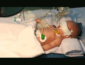 Bé sơ sinh nguy kịch vì bà nội lấy lưỡi lam cắt rốn