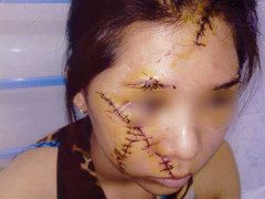 Rạch mặt nữ tiếp viên vì mâu thuẫn tiền 'boa'