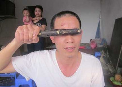 Điều tra vụ dân 'tố' công an vụt dùi cui vào mặt