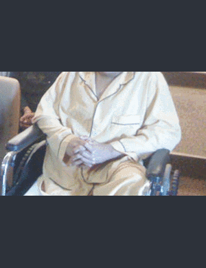 'Người chân voi' rùng mình khi nhìn giải phẫu chân mình